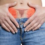 Ovarian Cancer: Complete Guide to Symptoms and Treatment