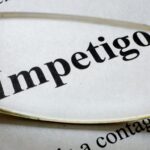 Comprehensive Guide to Impetigo