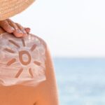 Complete Guide to Sunscreen Allergies