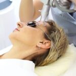 Comprehensive Guide to Laser Resurfacing for Anti-Aging