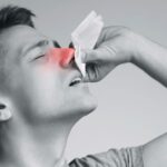 Nosebleeds: Comprehensive Guide to Causes and Prevention