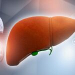 Comprehensive Guide to Fatty Liver Disease