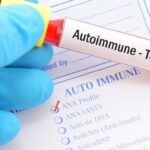 Drug-Related Immune Issues: Symptoms and Management Guide