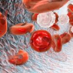 Thalassemia: Comprehensive Guide to Symptoms and Treatment