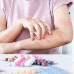 Understanding Medication Allergies: A Comprehensive Guide