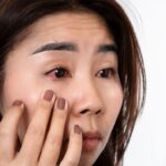 Complete Guide to Dry Eye Syndrome