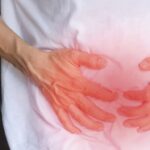 Crohn’s Disease: Comprehensive Symptoms and Treatment Guide