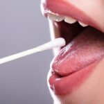 Xerostomia (Dry Mouth): Complete Guide to Management